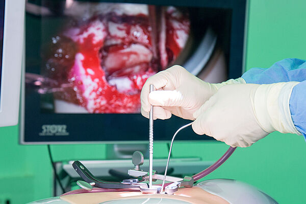 Die Hände eines Arztes üben am Simulationssystem RealSpine.